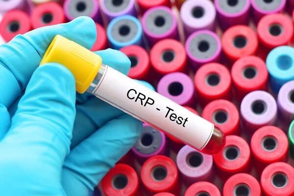 CRP hodnoty prozradí, zda potřebujete antibiotika nebo stačí čaj a klidový režim - MotherClub.cz