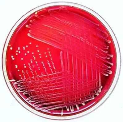 Obecná charakteristika Corynebacterium, taxonomie, morfologie, kultura / Biologie | Thpanorama - Udělej si dnes lepší!