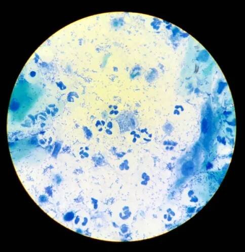 Zobrazit v mikroskopu na Trichomonas. — Stock obrázek