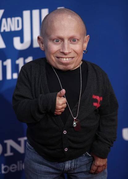 Pure Ugliest Celebrities: Most Bad Looking Famous People