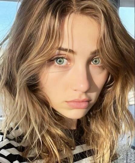 Emily Rudd - Forehead, Nose, Cheek, Skin, Lip, Chin, Eyeb...