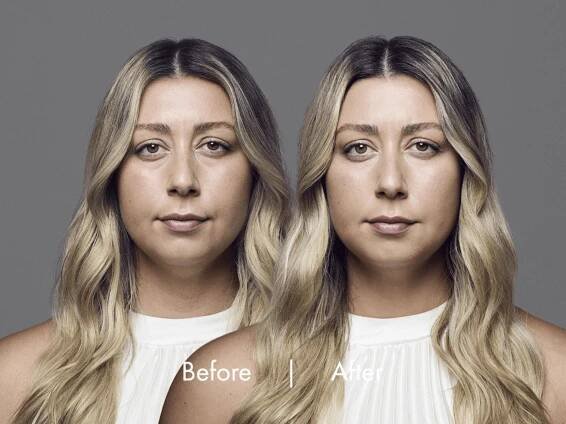 California Coastal Dermatology | RHA® Collection 