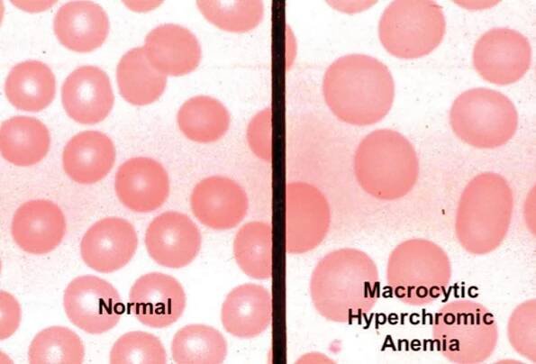 Interpreting Blood Films 1