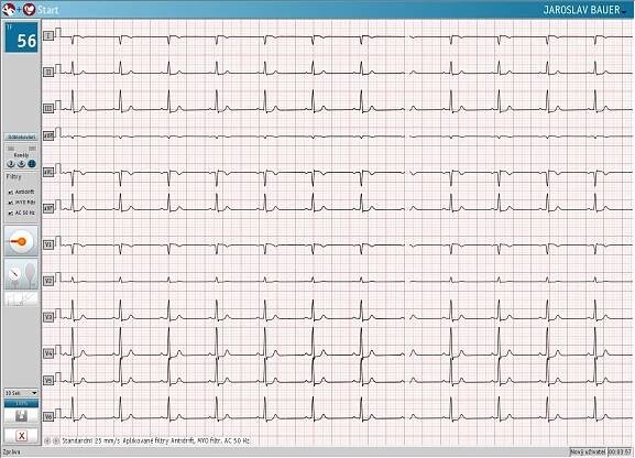 Klidové PC-EKG PADSY-EKG Bluetooth - COMPEK MEDICAL SERVICES, s.r.o.