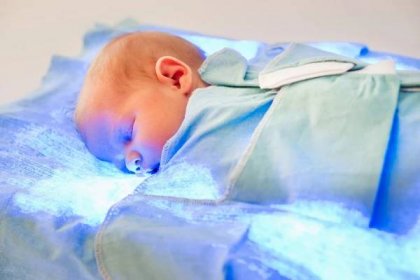 A newborn baby getting phototherapy (light therapy) treatment.