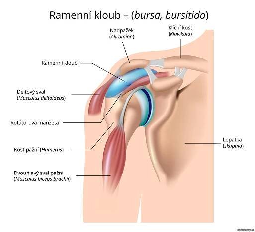 Ramenní kloub – bursa, bursitida