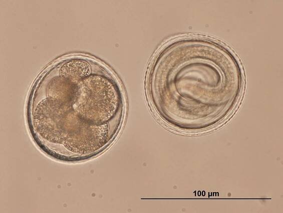 Soubor:Toxocara embryonated eggs.jpg – Wikipedie