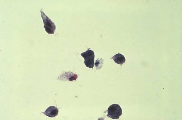 Trichomonády