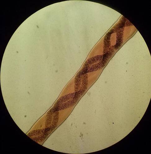 Body of female Angiostrongylus vasorum, detail of white genital strands wrapped around the digestive tract