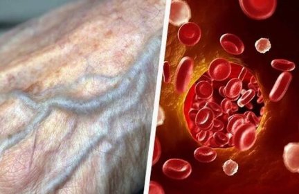 Jak zlepšit krevní oběh přirozenou cestou a předcházet tak řadě zdravotních potíží