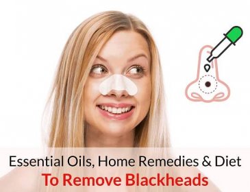 Essential Oils, Home Remedies & Diet To Get Rid Of Blackheads