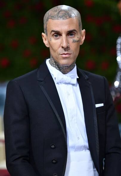 Travis Barker’s Health Scares, Injuries Through the Years