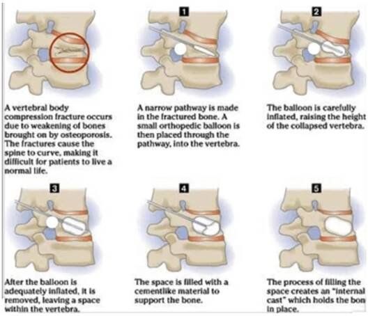 Best Spine Surgery Specialist Doctor in Kolkata | Dr Vignesh