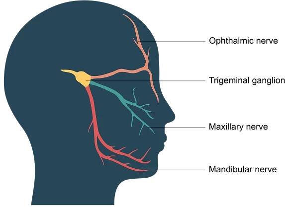 Trigeminal neuralgia