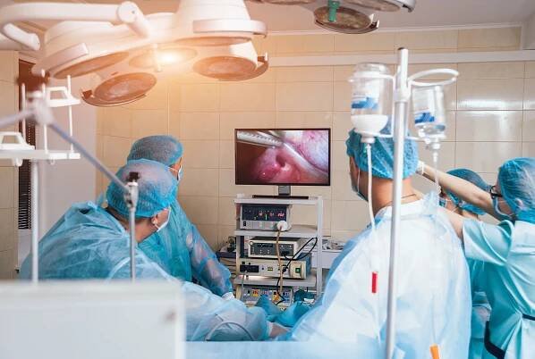 Proces operace gynekologické operaci laparoskopickou technikou. Skupina lékařů v operační místnosti s vybavením chirurgie. Pozadí — Stock obrázek
