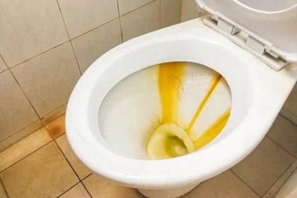 Jak efektivně vyčistit usazeniny v toaletě. Zvolte jednoduchý a zároveň účinný postup