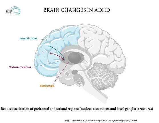 Neurobiology of ADHD: Key Insights into Brain Function | Psych Scene Hub