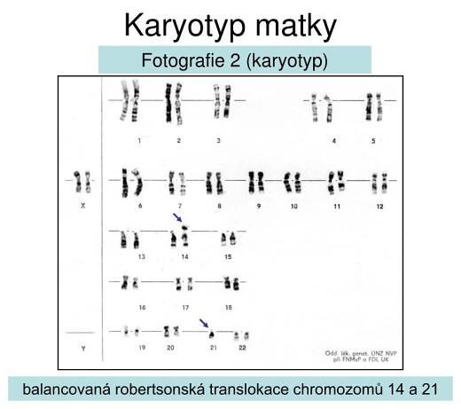 PPT - Strukturní chromozomové aberace PowerPoint Presentation, free download - ID:6120867