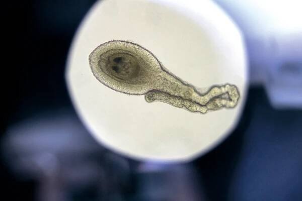 Larva tasemnice krysí pod mikroskopem.