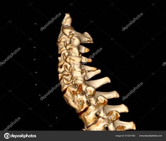 Stáhnout - CT sken páteře nebo krční páteře 3D vykreslování pro diagnózu zlomeniny krční páteře v případě traumatu. — Stock obrázek