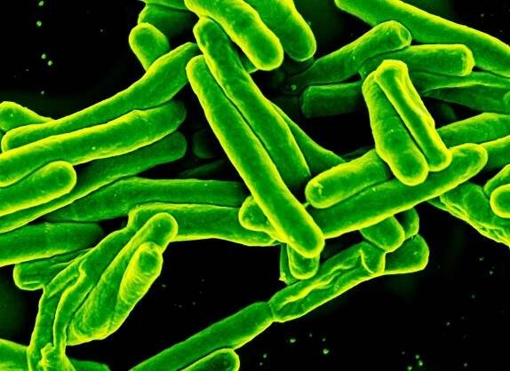 100 Years Of Tuberculosis Vaccine And Yet The Killer Is Still Among Us