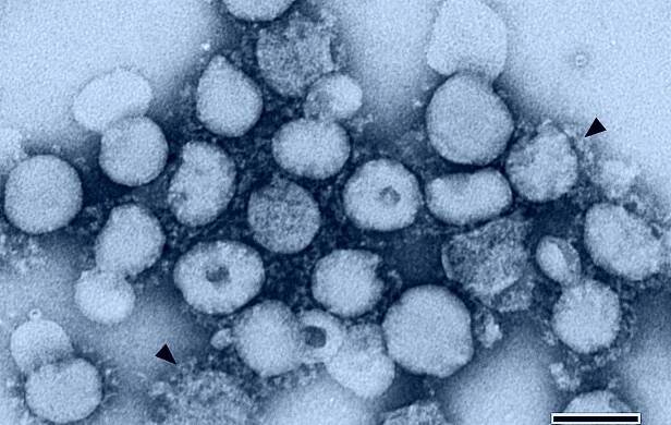 SARS – kapesní pandemie - Časopis Vesmír