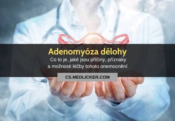 Adenomyóza dělohy: příčiny, příznaky a léčba