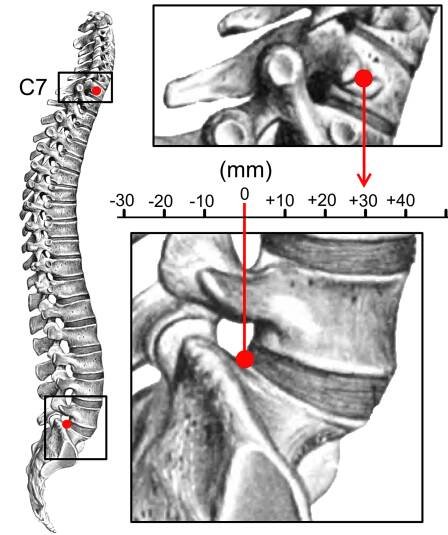 Soubor:Sagittal balance.png – Wikipedie