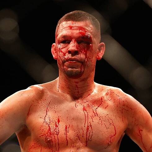 ‘I care about Nate Diaz a lot’: Khamzat Chimaev fight is not what people think, says UFC president Dana White
