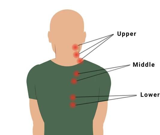 Neck and shoulder Trigger Points