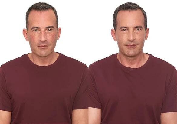 Bosley patient Jeff P before and after