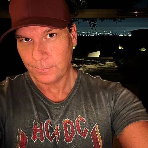Dane Cook Plastic Surgery
