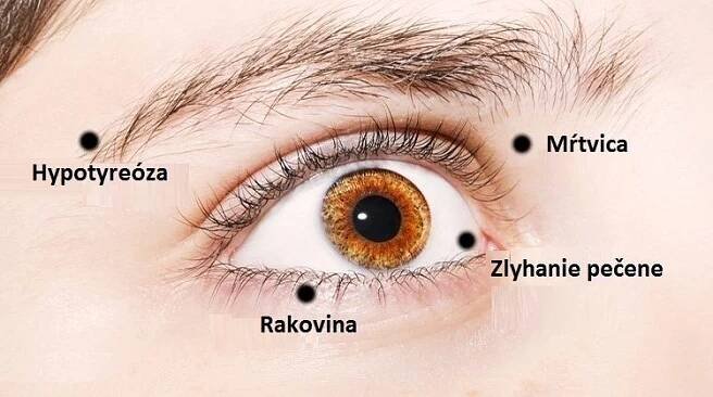 Vložte cesnak do mlieka a vyliečte astmu, zápal pľúc, artritídu a ďalších 8 chorôb - Domáca liečba