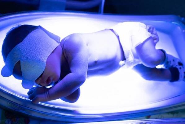 Hyperbilirubinémie – zvýšená hladina bilirubinu v krvi – příznaky, příčiny a léčba