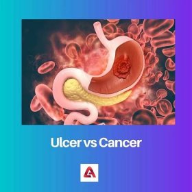 Vřed vs rakovina: Rozdíl a srovnání
