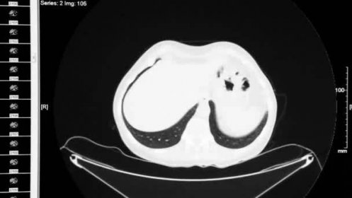 Počítačová tomografie vnitřních orgánů — Stock záběr
