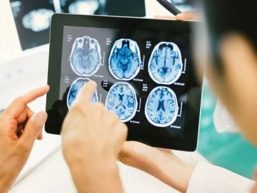 Brain Tumor: Types, Risk Factors, Symptoms, and Treatment