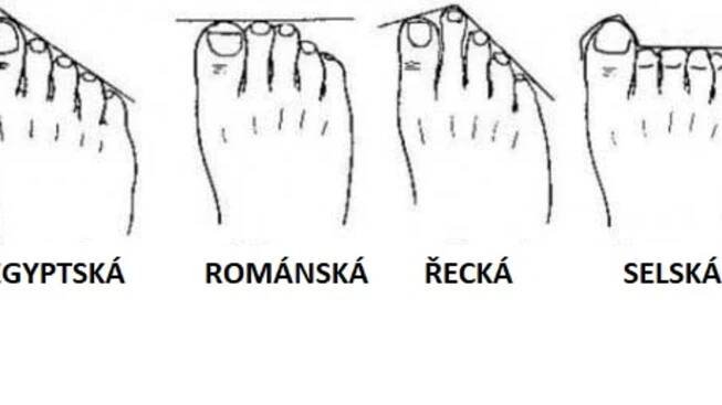 Čtyři typy nohou