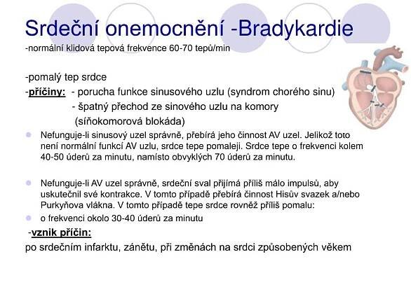 PPT - Kardiostimulátory PowerPoint Presentation, free download - ID:5429570
