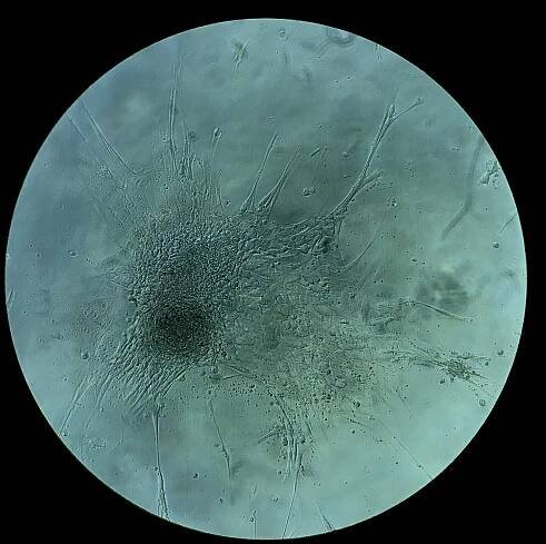 Nova Vita Laboratories | Advanced Regenerative Medicine & Amniotic Fluid Therapeutics