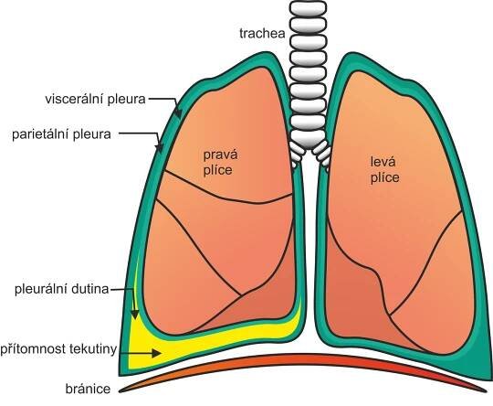 Pleuritida – WikiSkripta