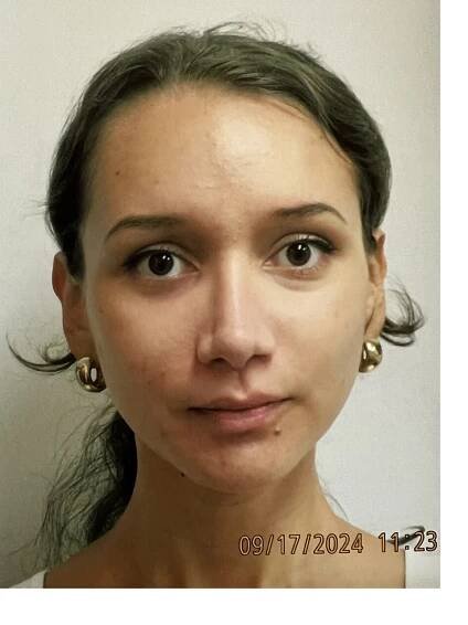 Case Study 228 - Dr. Ciardullo Rhinoplasty