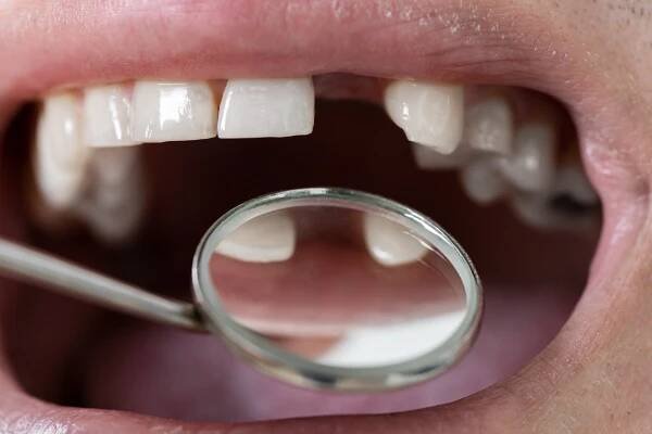 Pigs Can Regrow Their Adult Teeth. What If Humans Could, Too?