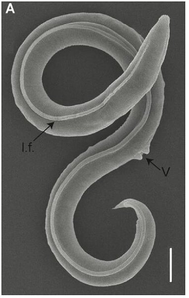 Oživené háďátko Panagrolaimus kolymaensis (1) - Oživené háďátko Panagrolaimus kolymaensis (1/6)