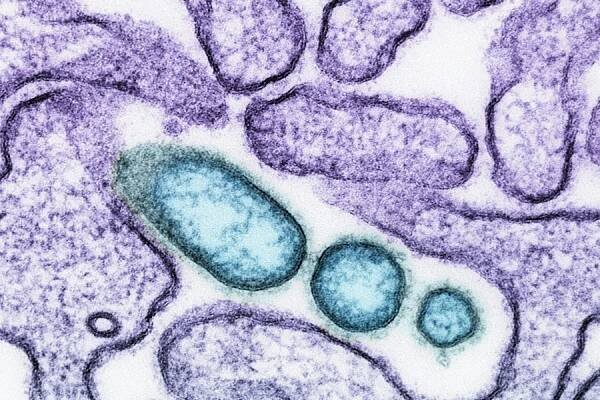 CIDRAP releases R&D roadmap for developing tools to combat Nipah virus