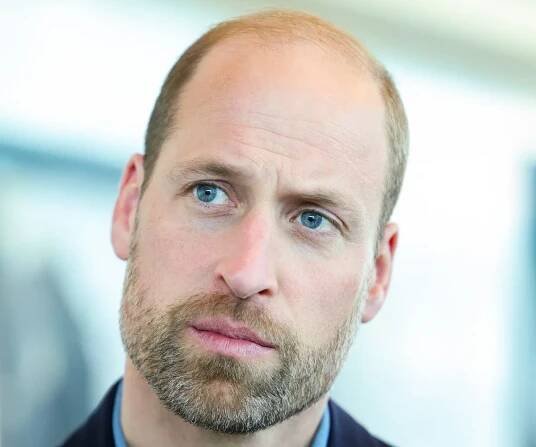 Prince William hair evolution | Now To Love