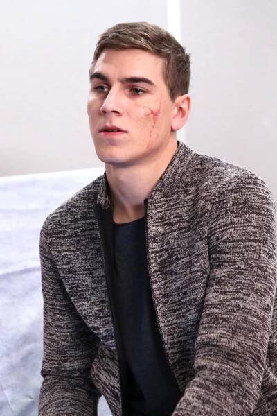 Herec David Gránský: Ošklivá bouračka! Má jizvu na tváři…. - Tojesenzace.cz