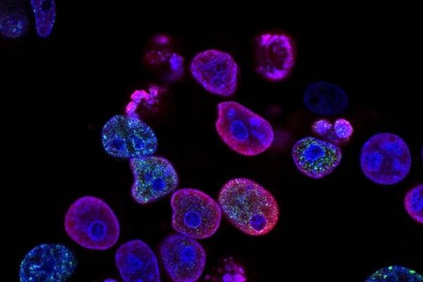 Koktejl chemoterapie a imunoterapie může pomoci v boji s rakovinou