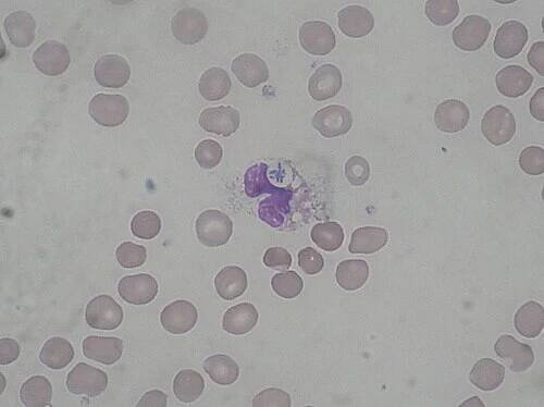 Pseudomonas aeruginosa – WikiSkripta
