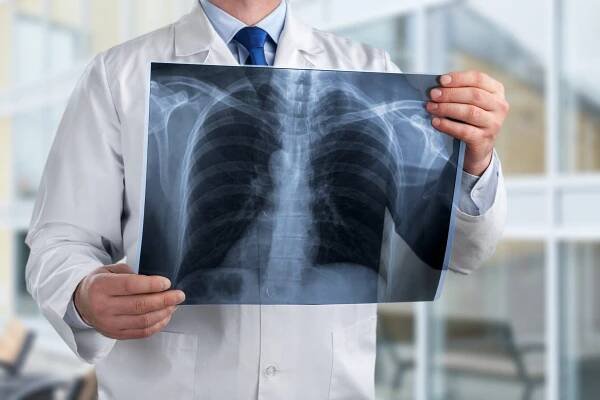 Incidence mozkových metastáz a intrakraniální aktivita soto...
